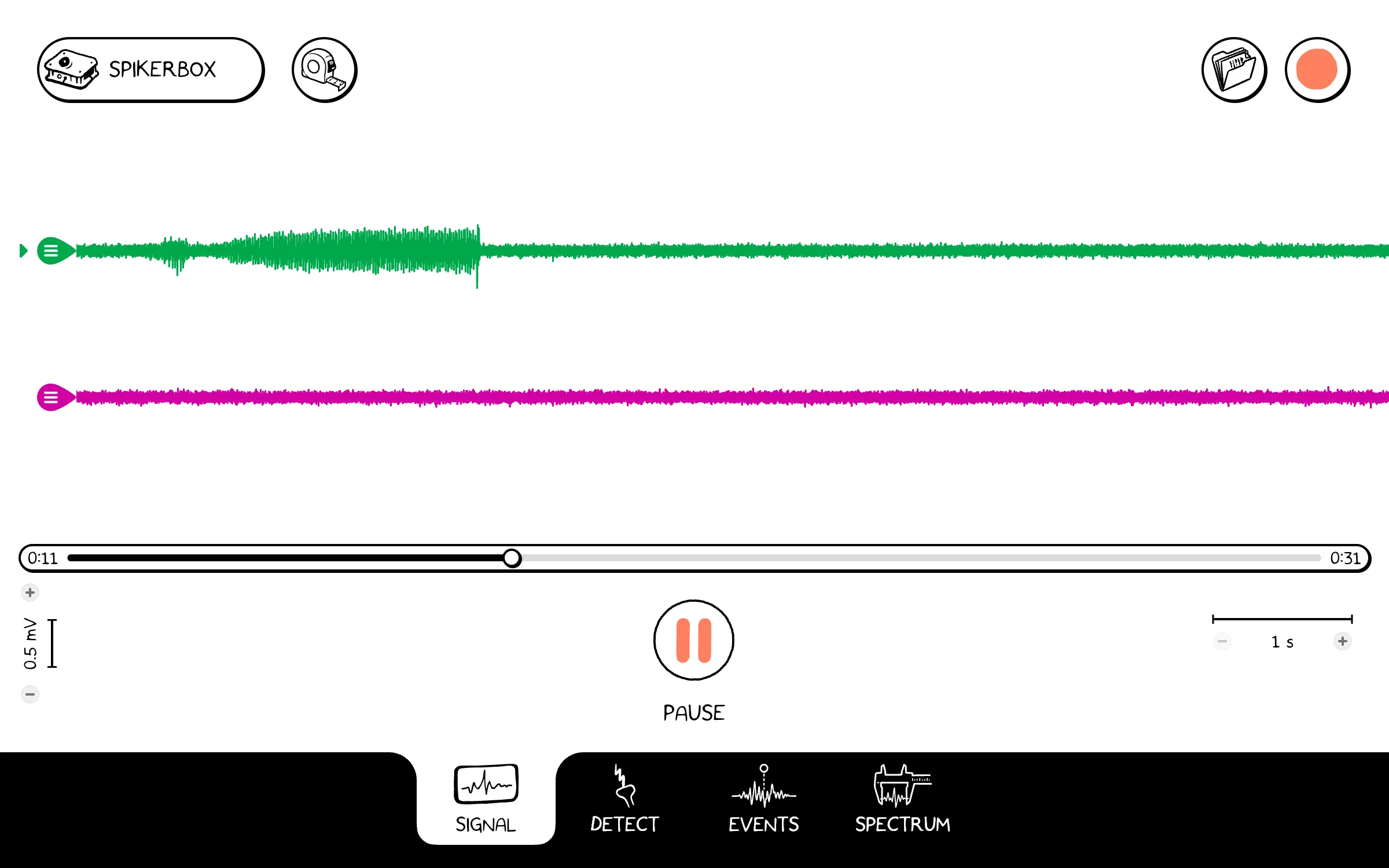 Spike Recorder playing back a two-channel recording from a Human SpikerBox. The green channel shows a burst of activity.